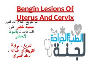 uterine leiomyomas fibroids Uterine leiomyomas fibroids or myomas