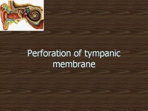 Perforation of tympanic membrane Intruduction n n Tympanic