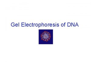 Gel Electrophoresis of DNA DNA as Forensic Evidence