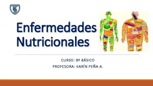 Enfermedades Nutricionales CURSO 8 BSICO PROFESORA KARN PEA