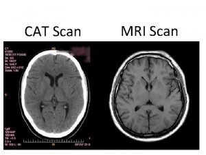 CAT Scan MRI Scan EEG PET Scan f
