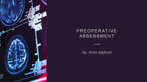 PREOPERATIVE ASSESSMENT By Amin alajlouni The stress of