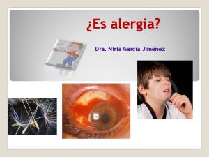 Es alergia Dra Niria Garca Jimnez Clasificacin Hipersensibilidad