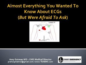 Almost Everything You Wanted To Know About ECGs