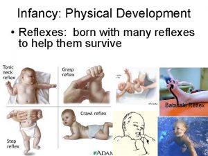 Infancy Physical Development Reflexes born with many reflexes