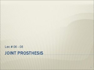 Lec 06 08 JOINT PROSTHESIS 1 OUTLINE Anatomy