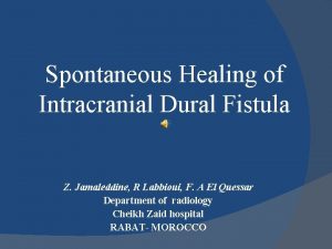 Spontaneous Healing of Intracranial Dural Fistula Z Jamaleddine