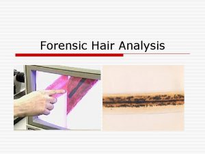 Forensic Hair Analysis Hair and Crime o Locards