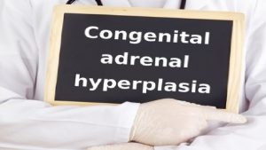 Non classic or late onset congenital adrenal hyperplasia