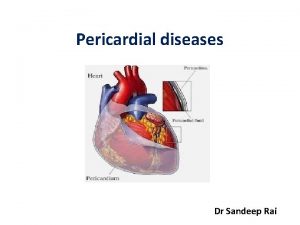 Pericardial diseases Dr Sandeep Rai Overview Introduction Acute