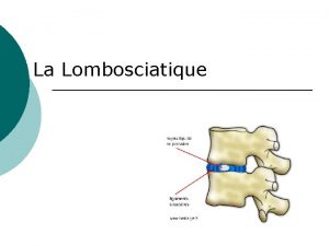 La Lombosciatique Plan Questce que cest Quel prise