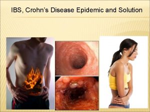 IBS Crohns Disease Epidemic and Solution GI TRACT