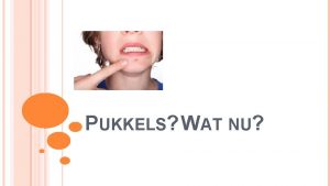 PUKKELS WAT NU WAAROM DEZE PRESENTATIE Quiz Uitleg