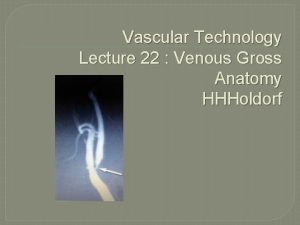 Vascular Technology Lecture 22 Venous Gross Anatomy HHHoldorf