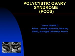 POLYCYSTIC OVARY SYNDROME PCOS Yasser Orief M D