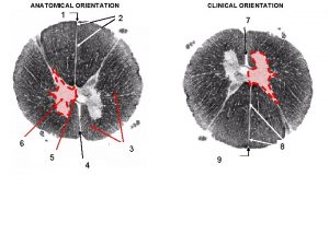 ANATOMICAL ORIENTATION Dorsal median sulcus 1 CLINICAL ORIENTATION