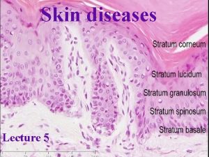 Skin diseases Lecture 5 Skin diseases Skin Complex
