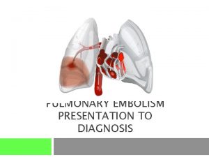 PULMONARY EMBOLISM PRESENTATION TO DIAGNOSIS Objectives Review the