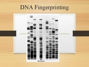 DNA Fingerprinting What is DNA Fingerprinting A technique