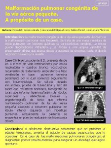 Malformacin pulmonar congnita de la va area pequea