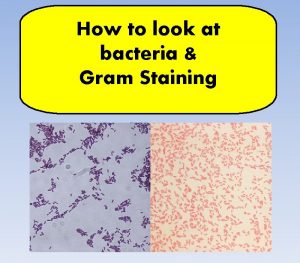 How to look at bacteria Gram Staining There