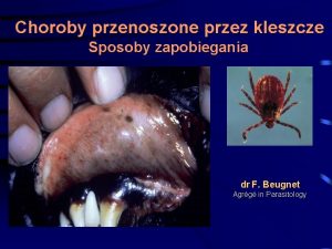 Choroby przenoszone przez kleszcze Sposoby zapobiegania dr F