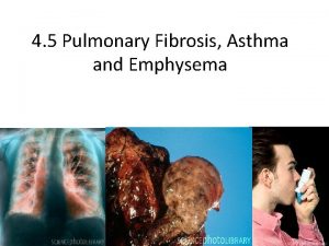 4 5 Pulmonary Fibrosis Asthma and Emphysema Learning