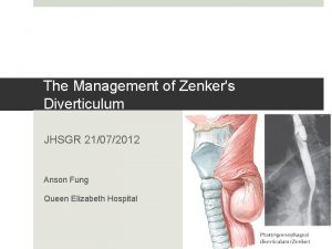 The Management of Zenkers Diverticulum JHSGR 21072012 Anson
