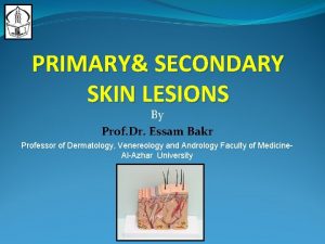 PRIMARY SECONDARY SKIN LESIONS By Prof Dr Essam