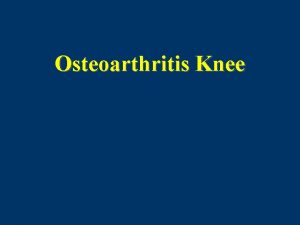 Osteoarthritis Knee Osteoarthritis of The Knee I Overview