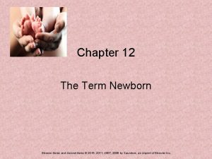 Chapter 12 The Term Newborn Elsevier items and