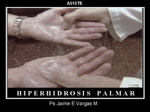 A 515 TE HIPERHIDROSIS PALMAR Ps Jaime E