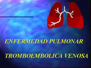 ENFERMEDAD PULMONAR TROMBOEMBOLICA VENOSA La enfermedad tromboemblica venosa