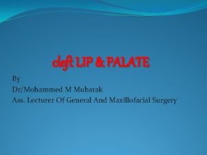 cleft LIP PALATE By DrMohammed M Mubarak Ass