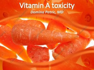 Vitamin A toxicity Domina Petric MD Introduction The