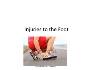 Injuries to the Foot Foot and ankle problems