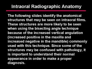 Intraoral Radiographic Anatomy The following slides identify the