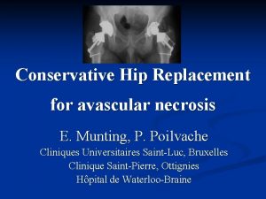 Conservative Hip Replacement for avascular necrosis E Munting