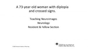 A 73 yearold woman with diplopia and crossed