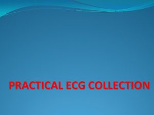 PRACTICAL ECG COLLECTION Normal ECG Lead Placement is