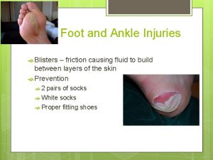 Foot and Ankle Injuries Blisters friction causing fluid