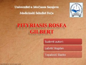 Univerzitet u Istonom Sarajevu Medicinski fakultet Foa PITYRIASIS