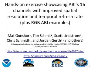 Handson exercise showcasing ABIs 16 channels with improved