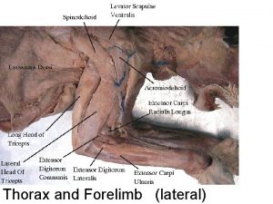 Thorax and Forelimb lateral 1 a Spinotrapezius 1