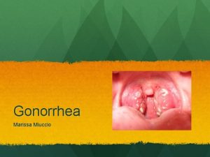 Gonorrhea Marissa Miuccio What is it Gonorrhea is