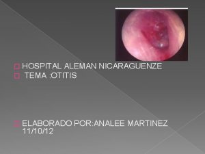 HOSPITAL ALEMAN NICARAGUENZE TEMA OTITIS ELABORADO POR ANALEE