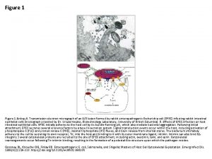 Figure 1 nbsp A Transmission electron micrograph of