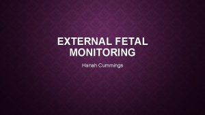 EXTERNAL FETAL MONITORING Hanah Cummings TYPES OF EXTERNAL