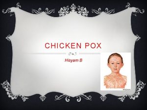 CHICKEN POX Hisyam B CHICKEN POX v Chicken