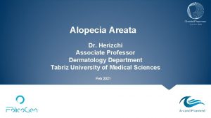 Alopecia Areata Dr Herizchi Associate Professor Dermatology Department